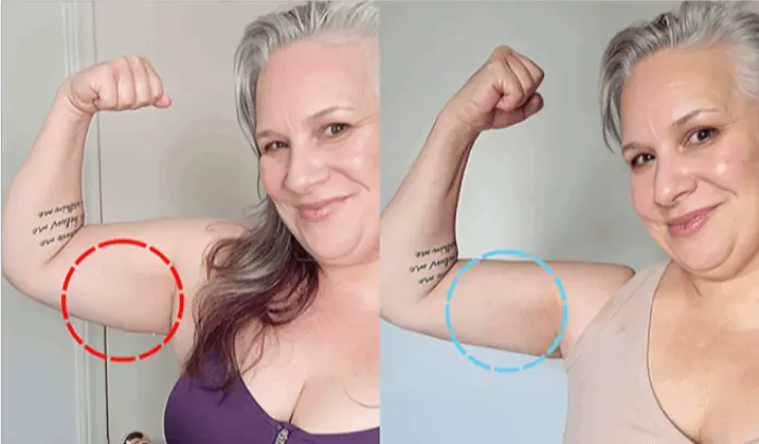 My Derma Dream Red Light Therapy customer Review Atena